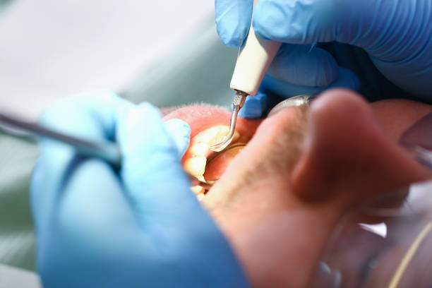 Best Emergency Tooth Extraction in Brewster, WA